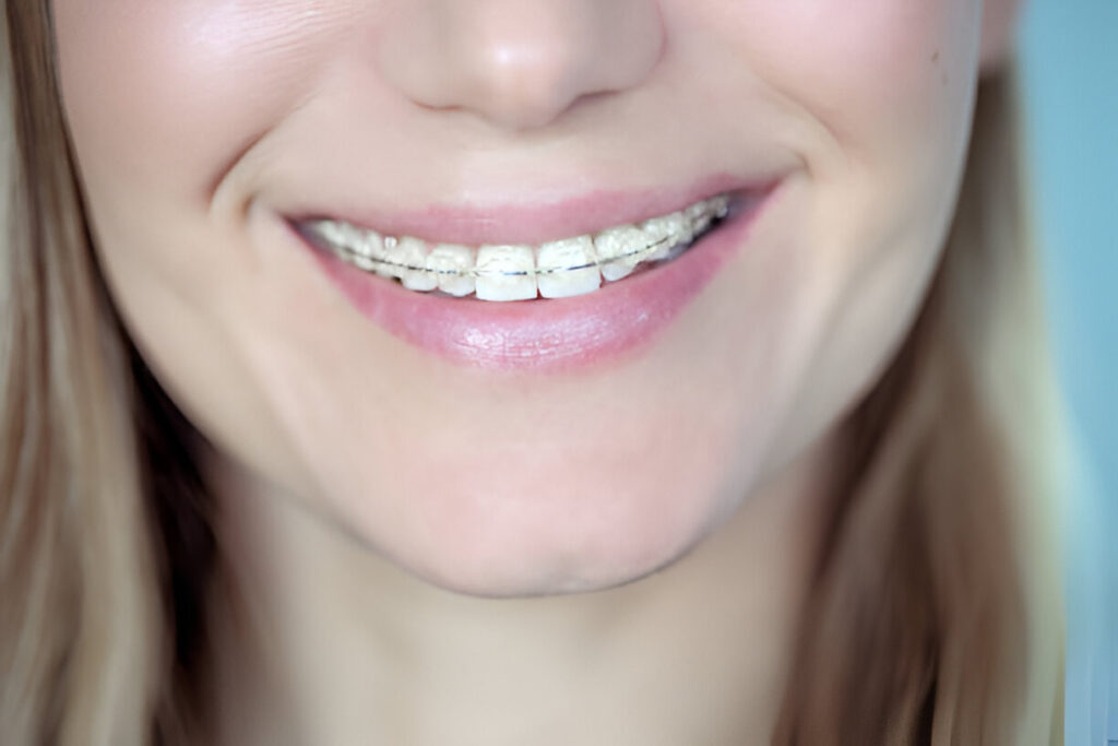 salem cosmetic dentist